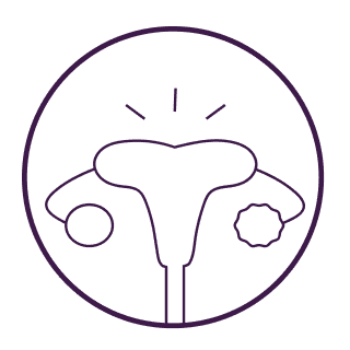PCOS Symptoms